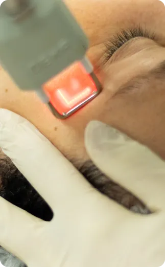 Laser de CO2